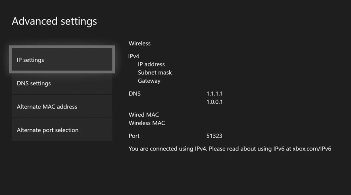 How to Fix Xbox Won't Connect to Wireless Network Saint